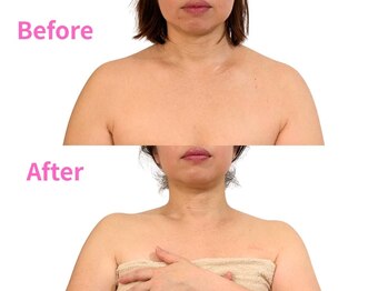 アファン 鶴見店(Afun)/【40代小顔】首が長くスッキリ◎
