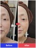 ◆至高のエイジングケア◆幹細胞×NMNで若々しさ復活フェイシャル+美首ケア付