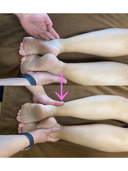 美容整体サロン オオカンシャ(okansha)/脚大逆転ビフォーアフター