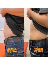 ヤマグチ美容整体院/電気をあてるだけ！簡単EMS♪