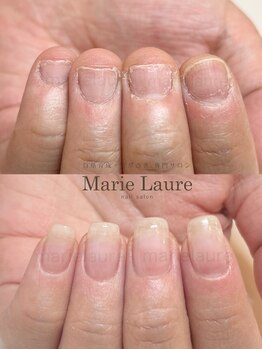 マリーロール 梅田店(Marie Laure)/深爪矯正/自爪育成/自爪風