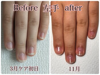 トイロ ネイル(Toiro Nail)/◇HAND◇クイックケア