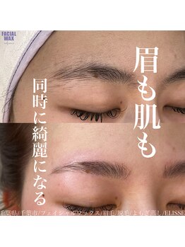エリス(ELISSE)/眉も肌も同時に綺麗になる