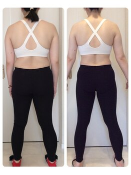 ホロニック ベルサンテ(Holonic Belle Sante)/メディセルハイブリッド