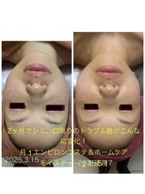 エステサロン エレガンス/