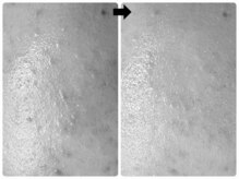 エフェクト 塚口店(effect)/Before After &nbsp;&nbsp;20代/2回目