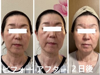 アクアナチュラ(ACQUANATURA)/鏡を見るのが楽しくなりました♪