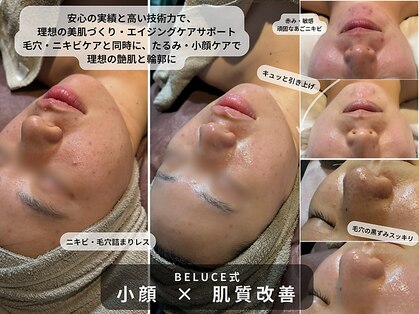 ベルーチェ(Beluce)の写真