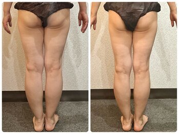 美容整体 ウェリナ 蟹江院/小顔矯正/骨盤矯正/痩身整体