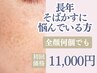 【そば◯す】昔からのその悩み、もう無くしましょ？そば◯す集中ケア￥11,000