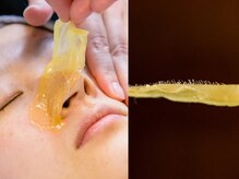 フェミソワン(FemiSoin)