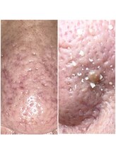 カミーシャ(KaMi-Sha)/【50代男性】エクストラクション