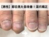 【男性専用】即日見た目改善！長さを出す深爪矯正初回お試し