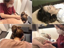 ぶっちょ整骨院 くずは鍼灸院の雰囲気（院長経験者「女性鍼灸師」確かな施術◎美容鍼も人気★）