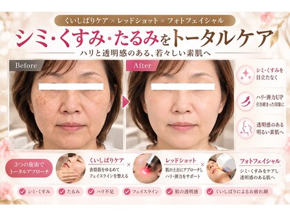 ラシクビューティールームの写真