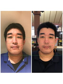 ハーボプラス(THE HEARBO plus)/現在男性は受付してませんが(^^;