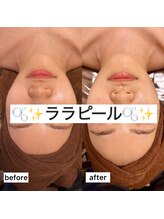 ホワイトアクア 錦糸町店(WHITE AQUA)/ララピール/東京/錦糸町/