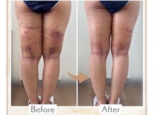 カノン(Kanon.)の雰囲気（施術後ケア/痩身/予防美容/インディバケアはお任せください）