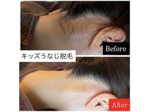 ヴァリエ(Varier)/Before after