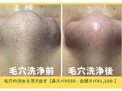 ビービー(BB)の写真