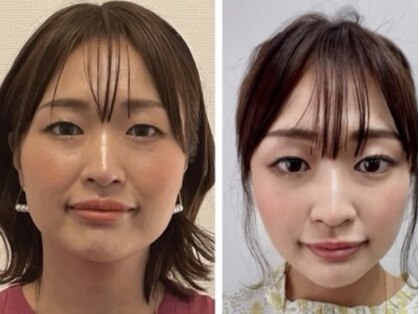 マーノ 福岡 薬院(mano)の写真