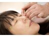 【美容鍼】お顔の肌質改善・むくみ解消　5000円→4000円