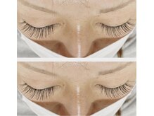 ベル(Belle)/◆フラットラッシュ200本