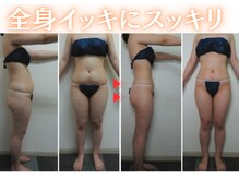 アルバ 広島店(ALBA)/エンダモロジーで綺麗に美痩せ
