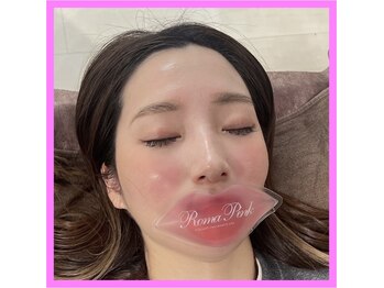 エステレア(Esthelea)/Roma Pink ローマピンク