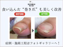 巻き爪補正店 鎌倉大船店の雰囲気（痛みのある巻き爪を痛みなく改善へ☆症例はフォトギャラリーへ！）