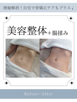 カルム(Calme)/腸揉みでウエスト、骨格を綺麗に