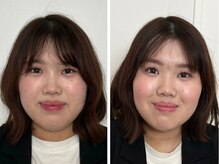 シュシュビエン(Chou Chou Bien)/トータル診断＋フルメイク