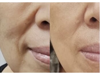 ルルアス(LuLu AS)/人気上昇塗るボト韓国