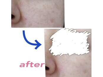 エス センダイ(S SENDAI)/モニター様募集中!