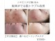 プシュケ(Psyche)の写真