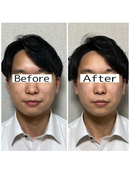 キュープ 池袋店(Qpu)の写真/【男性も通える結果重視実力サロン！】