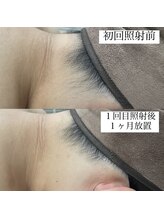 テンパ ビューティー(+10%beauty)/効果写真