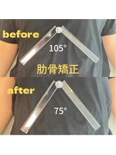 すまいむ整体院/肋骨矯正