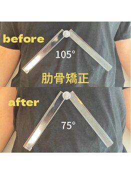 すまいむ整体院/肋骨矯正