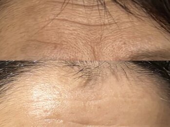 ヘルシースリムウエダ/しわ・たるみケア【ひばりが丘】