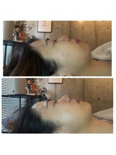 ジャスミン(Jasmine)/むくみ取れてスッキリフェイス★