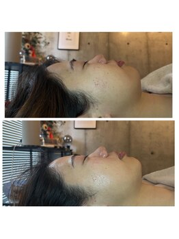 ジャスミン(Jasmine)/むくみ取れてスッキリフェイス★