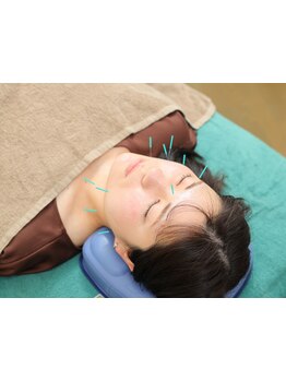 鍼灸施術を受けたい