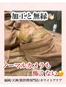 ホワイトアクア 福岡天神店(WHITE AQUA)/ハーブピーリング/ララピール