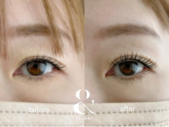 ムニ(muni)/&healthy【アンドヘルシー】