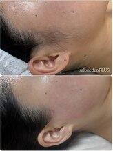 サロン エデンプラス(salon eden PLUS)/もみあげもお任せください♪