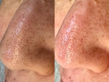 サイセイ(SAISEI)/