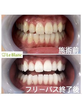 ルブラン 奈良店(Le Blanc)/毎日の隙間時間に