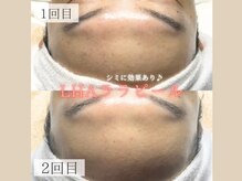 ダリア(Dahlia)/【シミ改善にララピール】