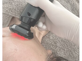 ラウレア(Laule'a)の写真/「最近、少しお疲れ？」と感じたら。40代からの輪郭ケア。ふっくら上向きのハリ。鏡を見るのが楽しみに。